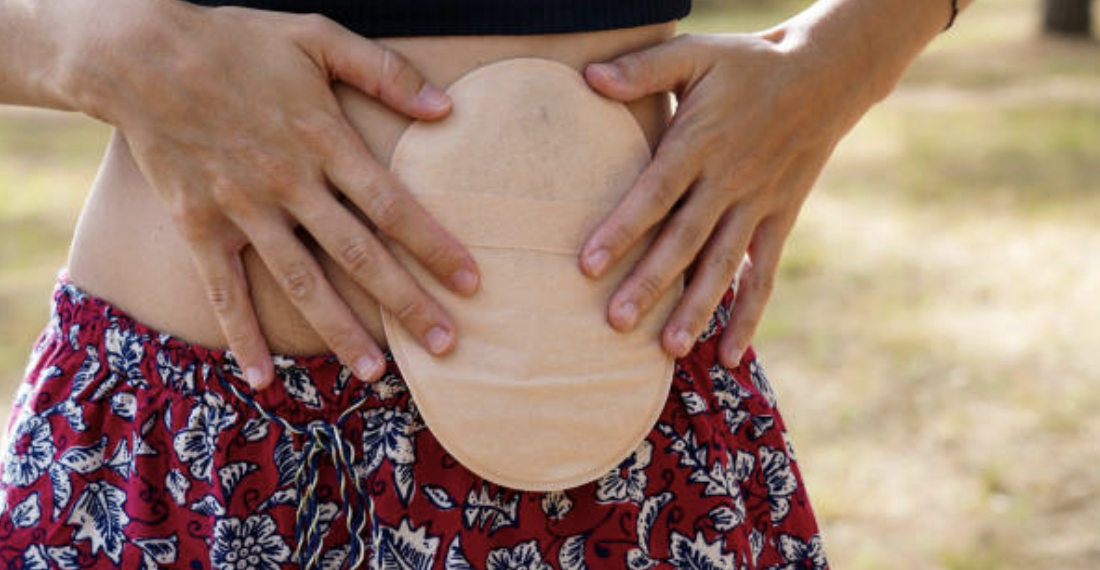 Colostomy UK Charity Receives IMPACT Award